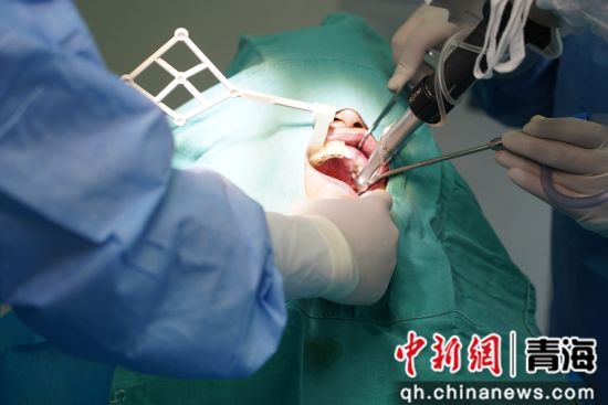 图为手术现场。西宁市第一人民医院供图 图为手术现场。西宁市第一人民医院供图